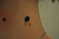 /album/kak-udalit-rodinki-/a002-1-3deni2-jpg/