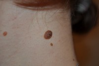 /album/fotogalereya/a001-ishodnik1-jpg1/