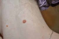 /album/fotogalereya/a003-17marta20103-jpg1/